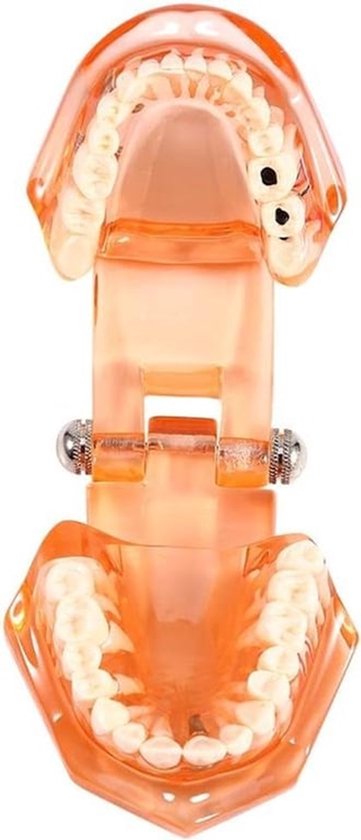 Dental model - verwijderbaar dental implant - demonstratiemodel - dental tool met verstelbare hoek 180° voor tandheelkundige school - studie - educatie