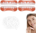 paar valse tanden, veneers, fineertanden, cosmetische tand opgelost, cosmetische tand opgelost, namaak, tijdelijke tandprothese met tandreparatiekralen, tand opgelost